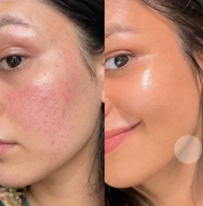 Before and after style calm glowing skin photo