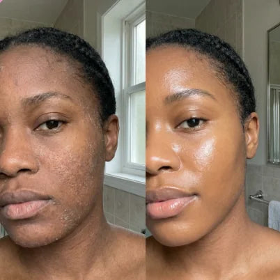 Before and after style hydrated looking skin photo